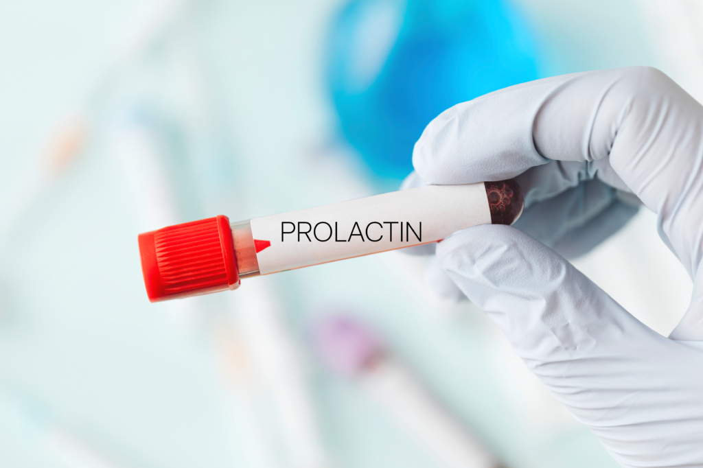 Prolactin LABWORK | Peter MD